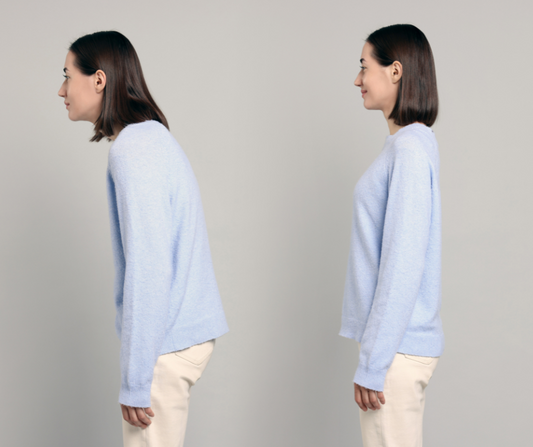 How to Sleep to Fix Rounded Shoulders and Improve Posture
