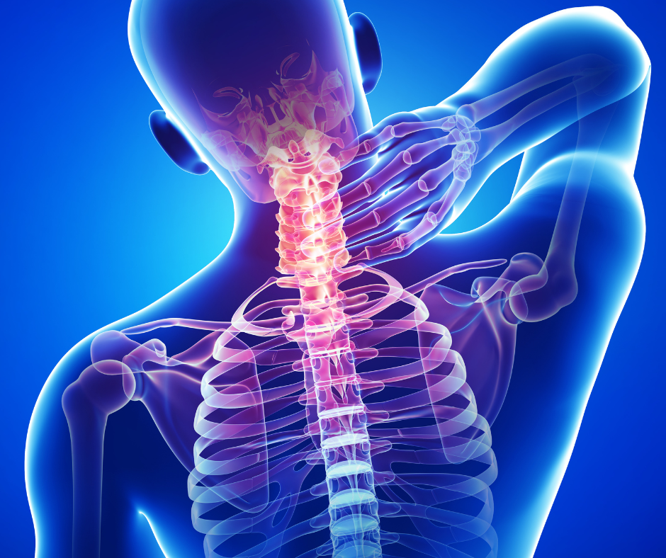 Can Neck Pain Be a Sign of Something Serious? Here’s How to Tell