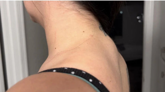 Does a Pillow to Get Rid of a Neck Hump ACTUALLY Work?