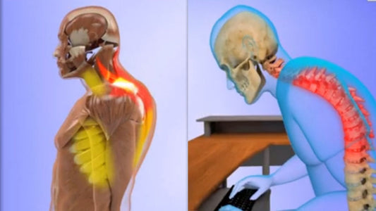 Five Expert Tips on How to Get Rid of Dowager's Hump FAST